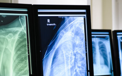 Dos and Don’ts of Purchasing Replacement Medical Equipment Parts