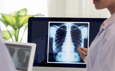 Five Things to Consider When Purchasing Medical Equipment Parts