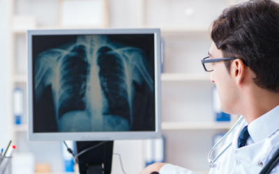 How AI and Automation Are Changing the Medical Imaging Industry